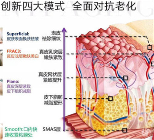 欧洲之星4D价格是多少？在4000-8000元不等，眼周、口周等不同部位为啥价格有差距