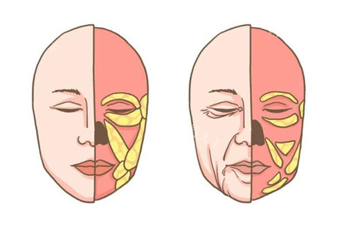 福斯溶脂注射针成效揭秘：究竟怎样？价格是多少？一文全知晓​