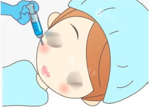 福斯溶脂注射针成效揭秘：究竟怎样？价格是多少？一文全知晓​