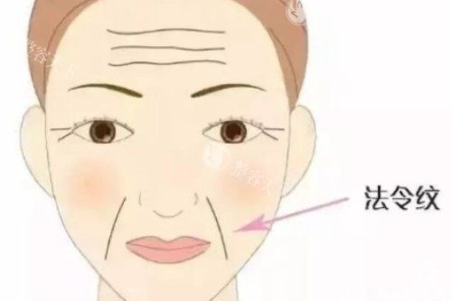 轻薄针和溶脂注射针的区别解析：从成分、作用原理、适用人群、结果维持时间等对比