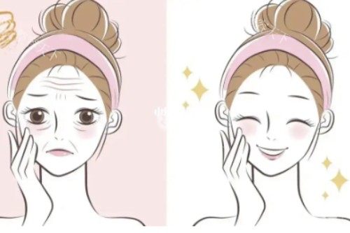 轻薄针和溶脂注射针的区别解析：从成分、作用原理、适用人群、结果维持时间等对比