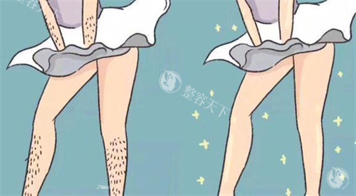 芜湖激光脱毛多少钱？下巴400+腋下|手臂300+私密部位1000+