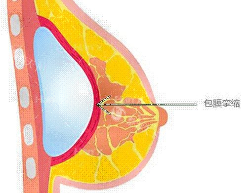 重庆莱沃医疗美容2025价格：鼻综合1.8万元起，眼综合6500元起，自体脂肪丰胸2.6万元起！