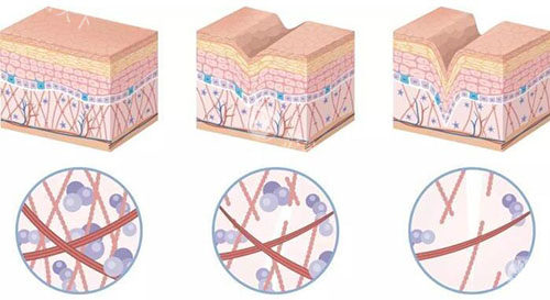 泉州哪家医院能做富贵包切除？推荐名单+术后护理指南，告别富贵包！