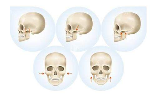 重庆夏德林医生颧骨手术怎么样​？听说不仅技术好.性价比也不错