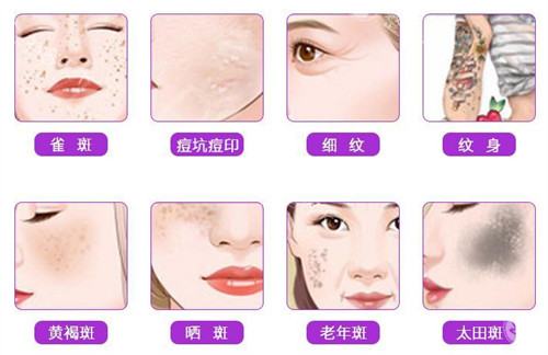 成都华美紫馨祛斑技术靠谱吗？皮秒、超皮秒真实结果对比，术后反黑问题怎么解决？