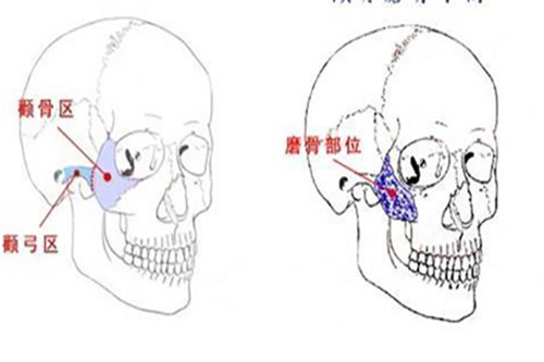 广州广大整形医院磨骨技术怎么样？真实反馈+医生测评，想变漂亮必看！