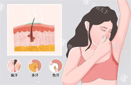 重庆哪家医院做腋臭手术好？实测5家热门医院，术后结果和修复体验全公开！