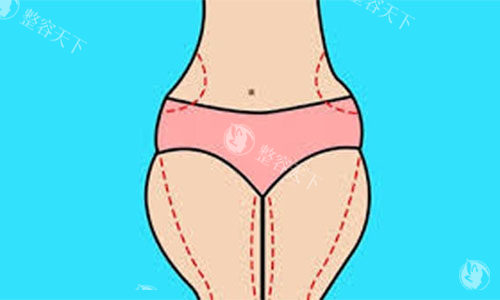 广州南方医院整形美容科价格贵吗？双眼皮、隆鼻、吸脂项目收费一览！