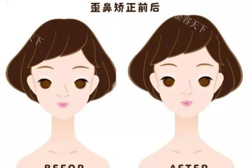 李东灿医生简介大公开！从资历到技术详细解析，帮你找到靠谱的整形医师！