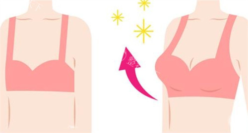 30 岁宝妈假体隆胸真实病例：哺乳后胸部下垂，手术让我重获自信！