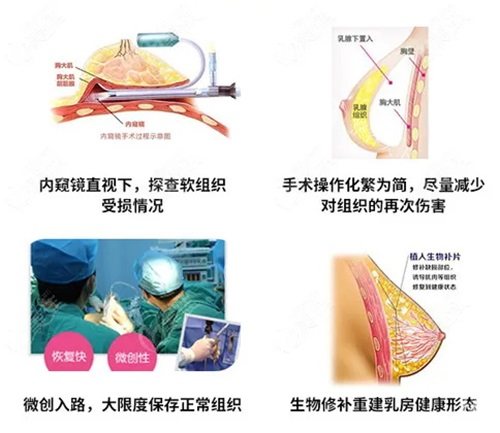 北京异物取出术收费标准表来了！详细解析手术费用，让你明明白白消费不花冤枉钱！