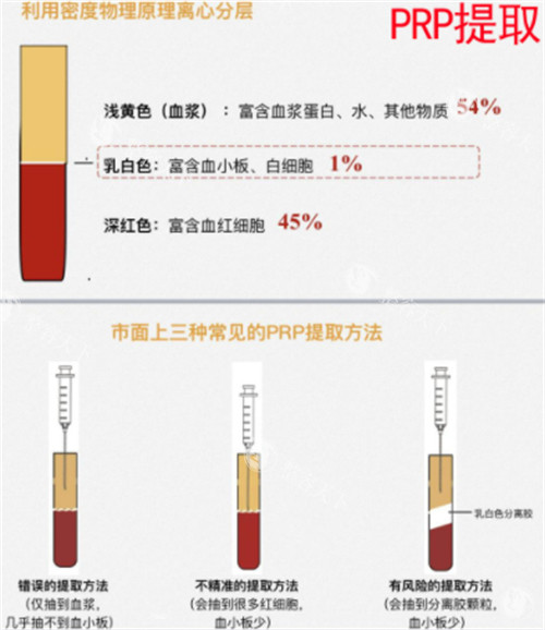 丽芙莎高潮针结果能维持多久？真实体验分享+术后护理，结果延长有妙招！