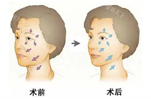 广州壹加壹魏露莎医生怎么样？专注面部年轻化注射医师，擅长眶周年轻化与脸部轮廓精细化雕塑