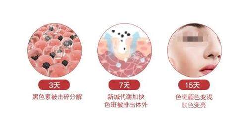 苏州点阵激光哪家医院结果好？价格、设备、医生技术大PK，痘痘肌必看！