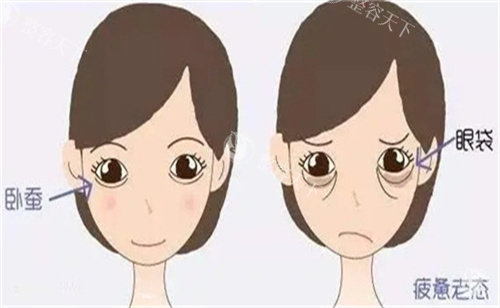哈尔滨名大医疗美容所院长做卧蚕再造怎么样?技术造诣深|审美非常好|临床病例很受好评