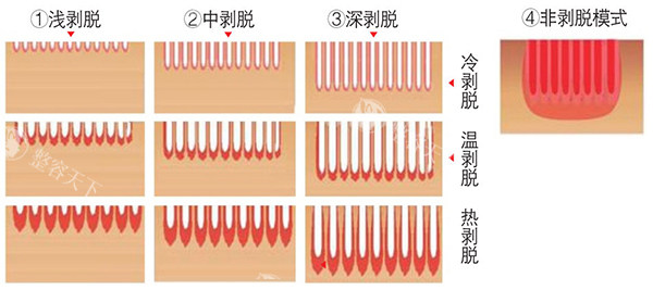 杭州薇琳做fotona4D哪位医生好一些？王婷婷|宋凯丽|孟庆炎等认证医师团，定制分层抗衰方案不踩雷！