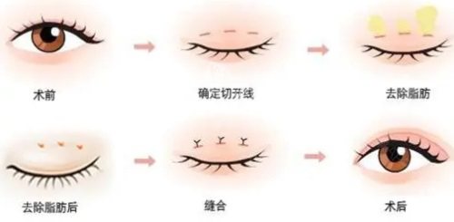 长春南关久诺美医疗美容怎么样，眼鼻整形手术做的非常好！