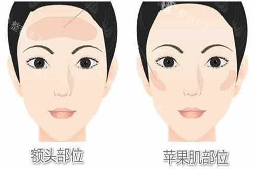 南昌整形医院价格表2025年详情：切眉手术3000元起/面部吸脂5000元起/玻尿酸丰额头2000元起