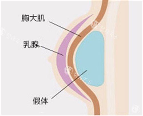 深圳美莱隆胸哪个医生好？徐占锋|郭杰|黎冻三位是隆胸建议面诊的医生~