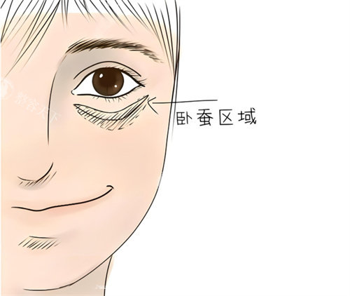 哈尔滨名大医疗美容所院长做卧蚕再造怎么样?技术造诣深|审美非常好|临床病例很受好评