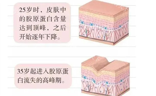 脸上注射胶原蛋白用什么牌子好？双美、薇旖美、弗缦和爱贝芙等可以放心选
