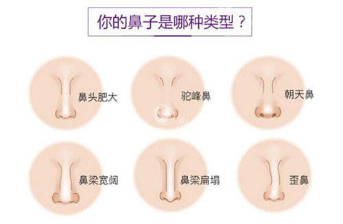 深圳李信锋是哪个医院的医生？一文揭秘其坐诊机构！