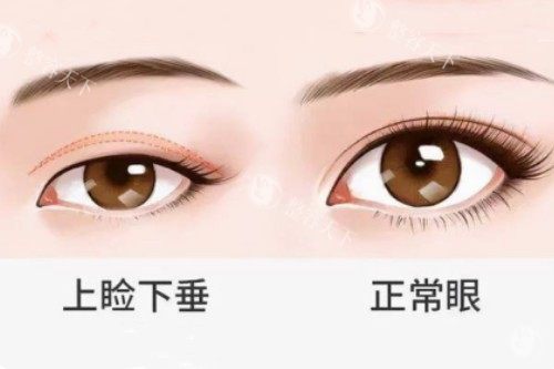 吴焱秋修复眼睛好吗？文内解析背景、技术实力、个性化设计、真实反馈等