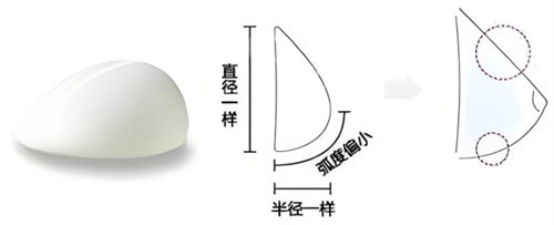 北京八大处隆胸哪个医生好？特色医生深度剖析