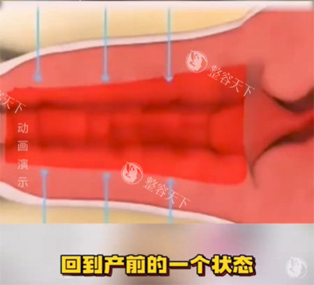 紧缩针预约怎么网上预约？24小时各城市紧缩针预约通道开启：可查价格、正规医院等