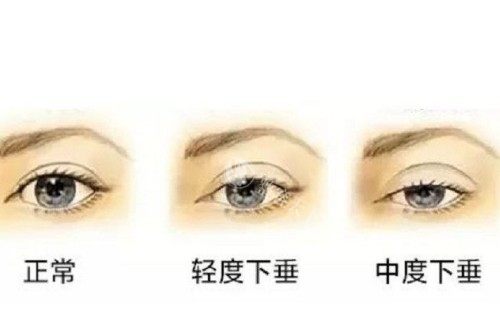吴焱秋修复眼睛好吗？文内解析背景、技术实力、个性化设计、真实反馈等