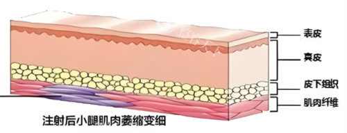 杭州艺星翟爽吸脂怎么样？解析背景、技术特点、术后结果、价格等