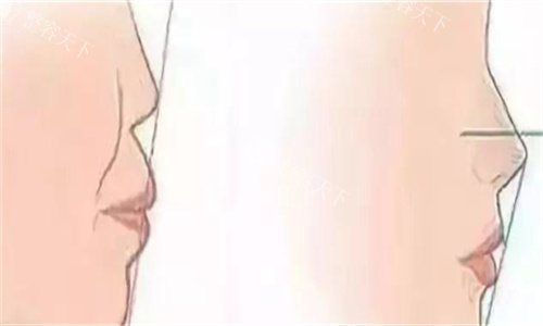 郑州缔莱美口碑炸裂的秘密：从眼鼻整形到抗衰项目，这些优势让患者追着推荐！
