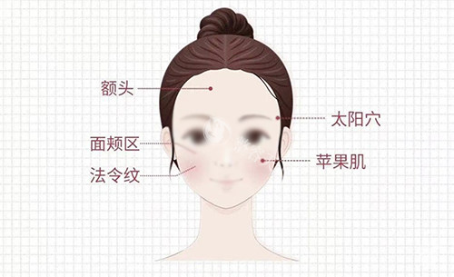 绍兴维美美容医院收费标准：公布2025热门项目眼/鼻/胸/注射价目表！