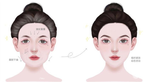 4998元能做幼态脸吗？低价套餐是否靠谱？医师解读！