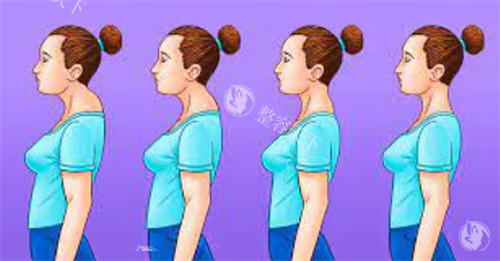 黄学峰治疗富贵包怎么样？网友评价说技术没毛病，分析黄学峰治疗富贵包优势/预约方式/收费