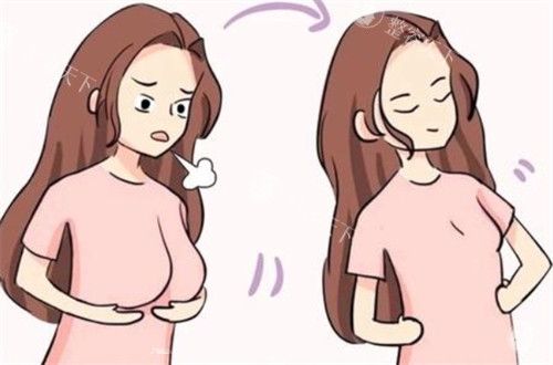 西安李高峰缩胸手术做得好吗？双环提升术同步矫正下垂+饱满塑形，触感比真胸还软，宝妈圈强推！