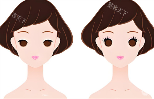 广州美涵整形医院怎么样?是正规的吗?地址在哪里?附简介地址和口碑评价!