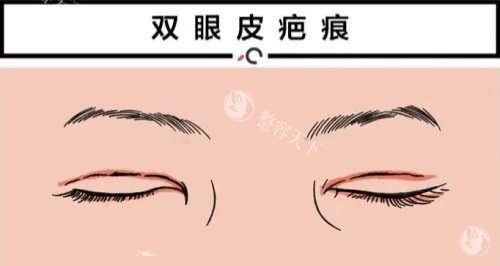 宜昌整形医院价格表2025年揭秘：埋线双眼皮3000元起/激光除皱3000元起/硅胶假体隆鼻8000元起