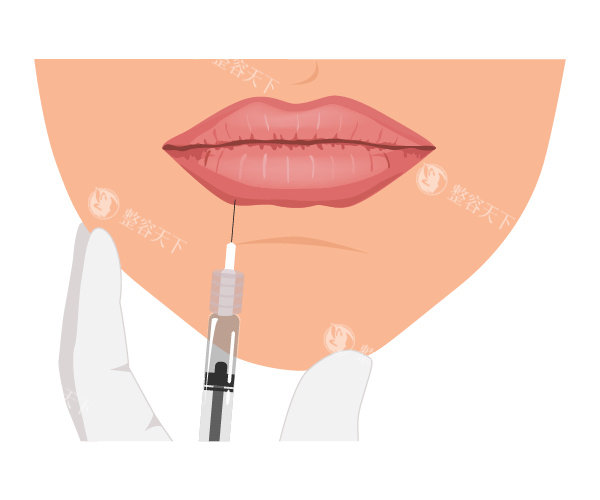 海魅玻尿酸好还是乔雅登好？从成分与技术、改善优势、适用人群、术后展现等对比