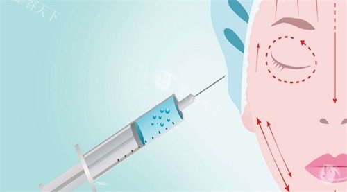 晶肤医美注射价格表查询，海薇玻尿酸2000起/乔雅登雅致8900起/宝尼达18000起！