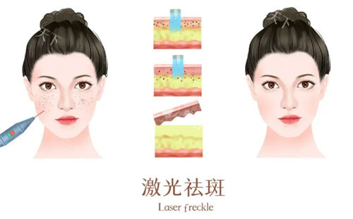 西安星容妍医疗美容怎么样正规吗?地址在哪里?分享简介地址和预约挂号方式!