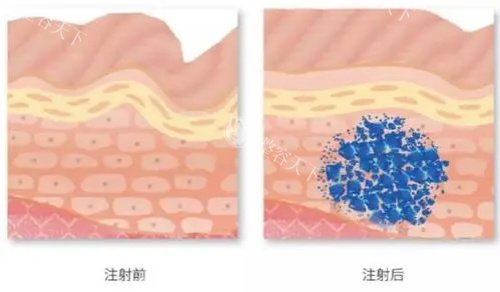 深圳龙华罗文医疗美容医院地址在哪？金銮国内外商务大厦201-202准导航，交通便捷不绕路！
