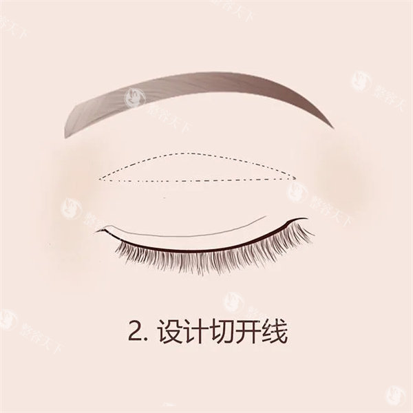 沧州京美整形受欢迎项目公开，双眼皮/隆鼻/脂肪填充都有特点口碑好！
