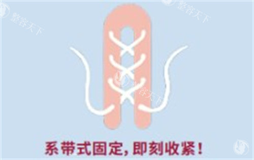 八爪鱼紧缩术价格多少钱?价格2万-9万元起!成效/维持年限揭晓