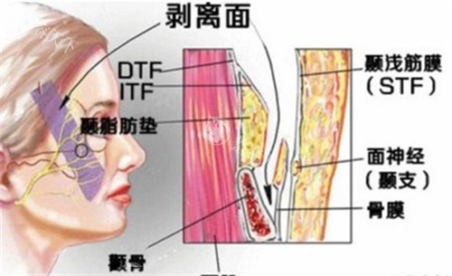 许凤芝做面部轮廓提升好吗​？从众多接受过许凤芝面部轮廓提升手术的求美者反馈来看，术后结果令人满意