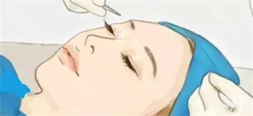 深度解析！成都杨迪做双眼皮修复手术究竟靠谱吗？