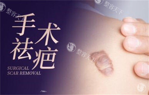 深圳悦尔医疗美容疤痕科怎么样?是深圳瘢痕修复技术好口碑好的正规医美!