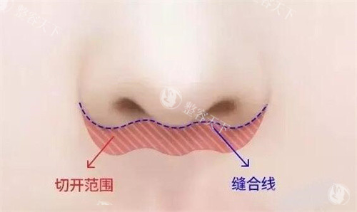 北京蕾士悦容医疗美容怎么样?蕾士悦医疗美容唇部技术怎么样啊?