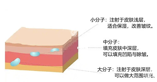 公主玻尿酸和丽缇玻尿酸哪个好用？从品牌背景、成分、功效、适用人群等对比分析